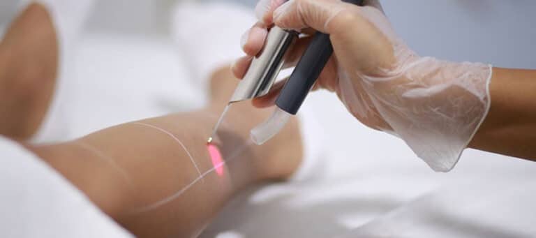 Alexandrite lazer epilasyon – Dr. Yetkin Bayer Kliniği