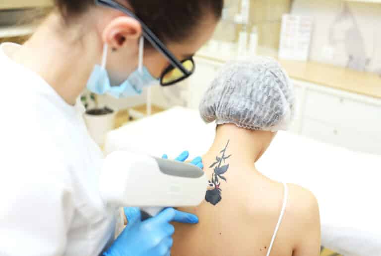 Lazer ile dövme silme uygulaması – Dr. Yetkin Bayer Kliniği